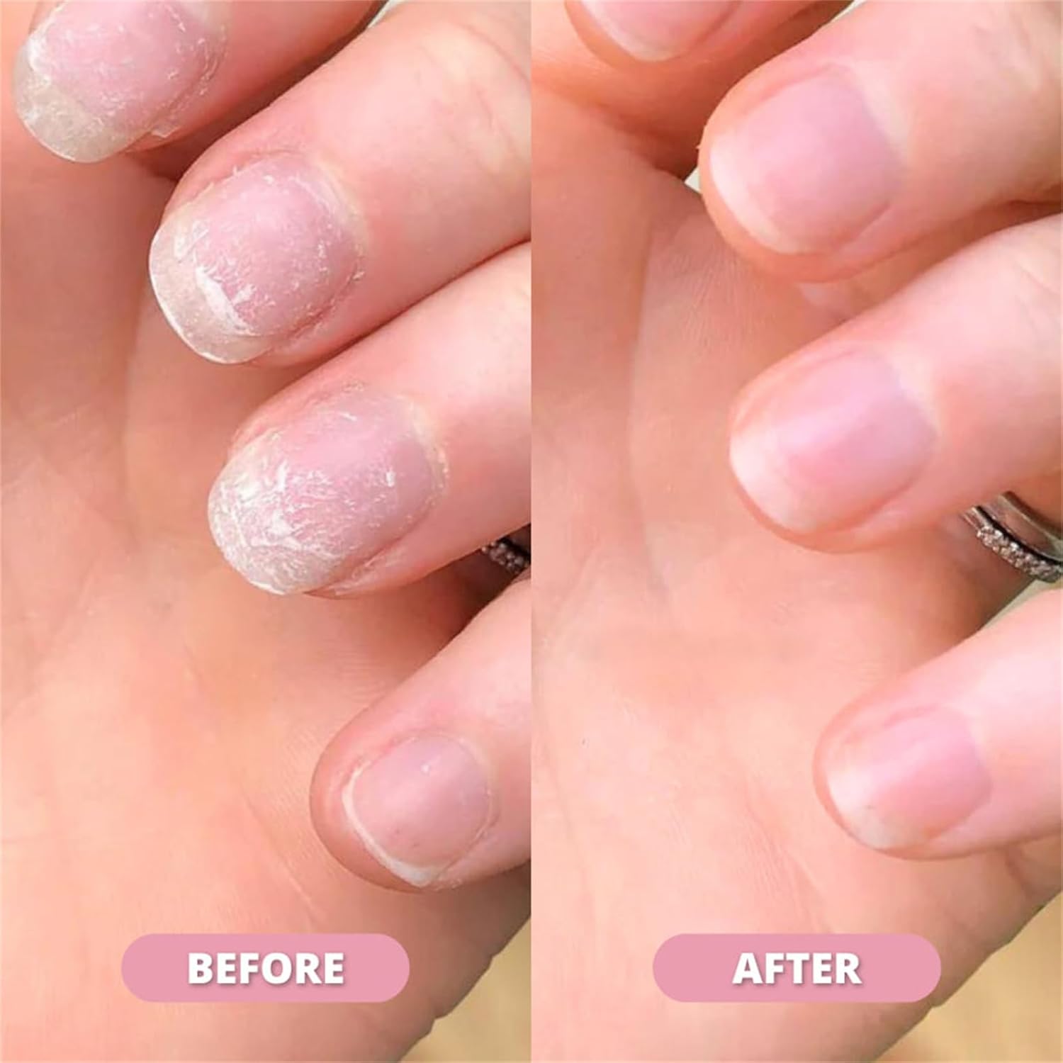 Nail Growth & Cuticle Oil Pen – Radiant Serum Nutrient Pen