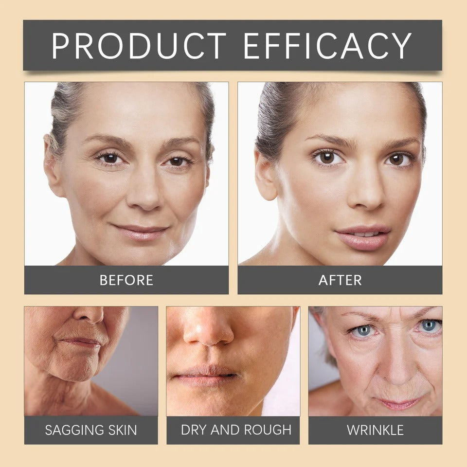 Botox Bee Venom Whitening Cream 20g