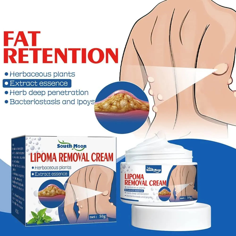 South Moon Lipoma Removal Cream – Herbal Extract Essence Skin Care Treatment (50g)